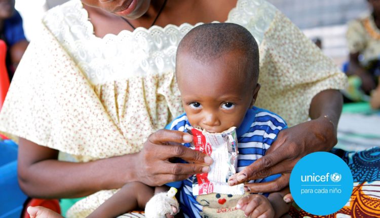 UNICEF tratará a mil niños en el país ante posible desnutrición aguda por efectos de COVID